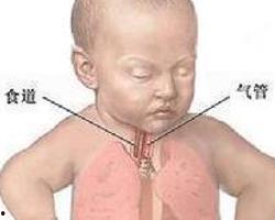 吮乳图片,探寻婴儿吮乳的温馨瞬间